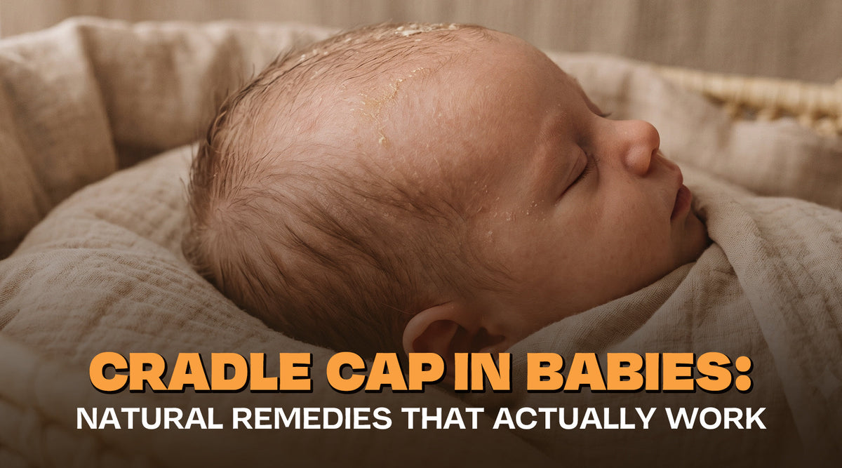 Cradle Cap in Babies: Natural Remedies That Actually Work