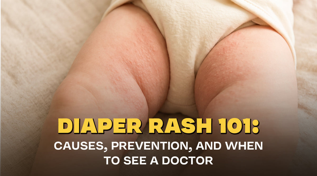 Diaper Rash 101: Causes, Prevention, and When to See a Doctor