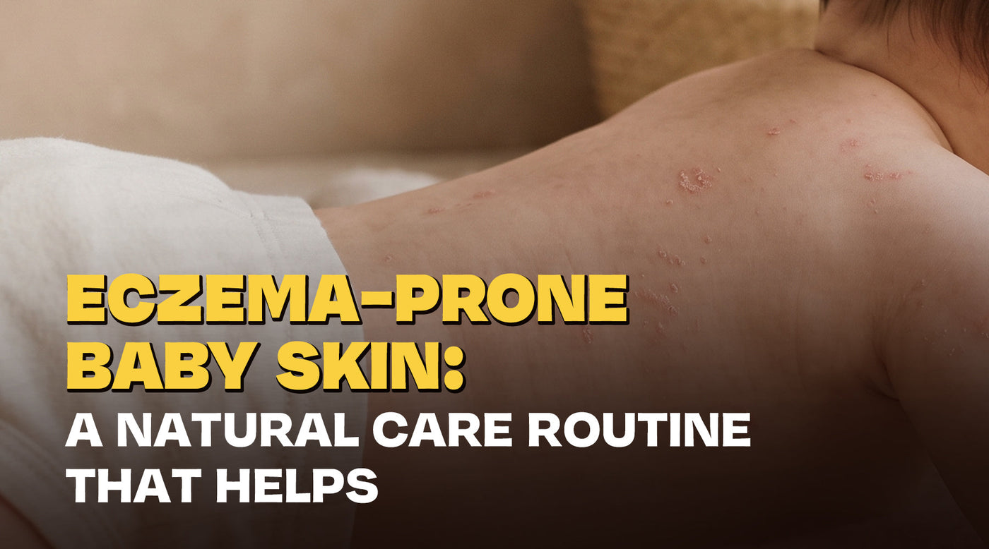 Eczema-Prone Baby Skin: A Natural Care Routine That Helps