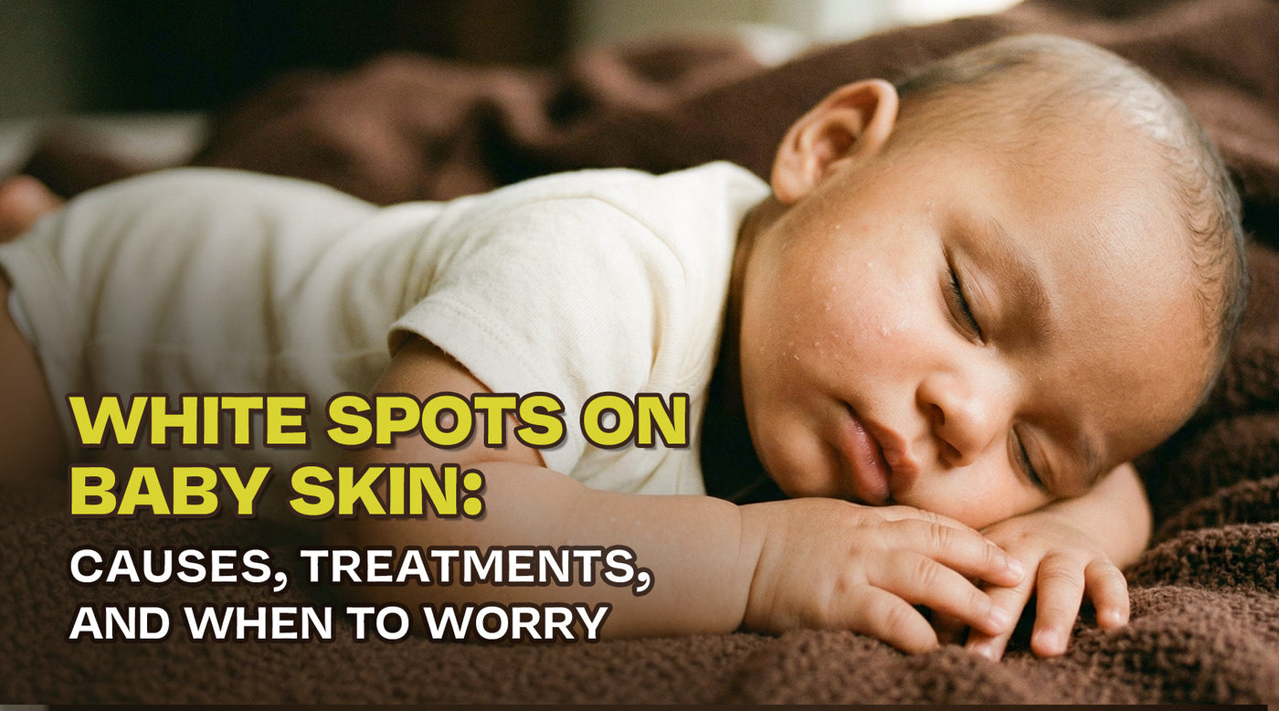 White Spots on Baby Skin: Causes, Treatments, and When to Worry